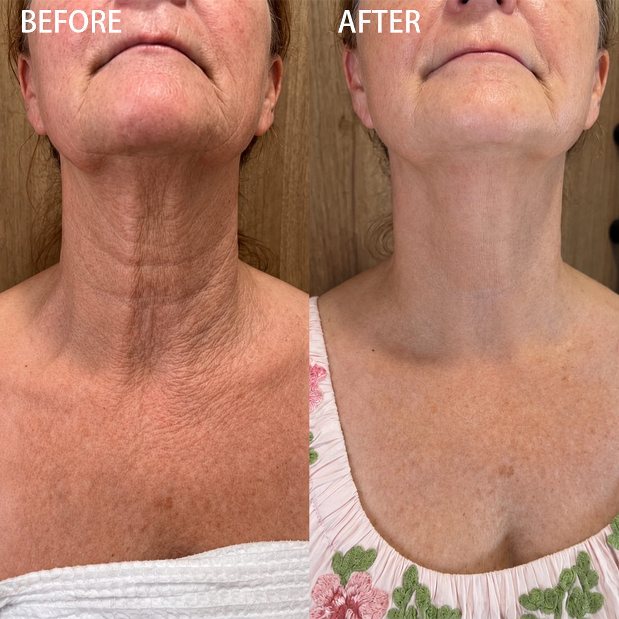 JOYIVORA PDRN WRINKLE-LIFT TIGHTENING CREAM