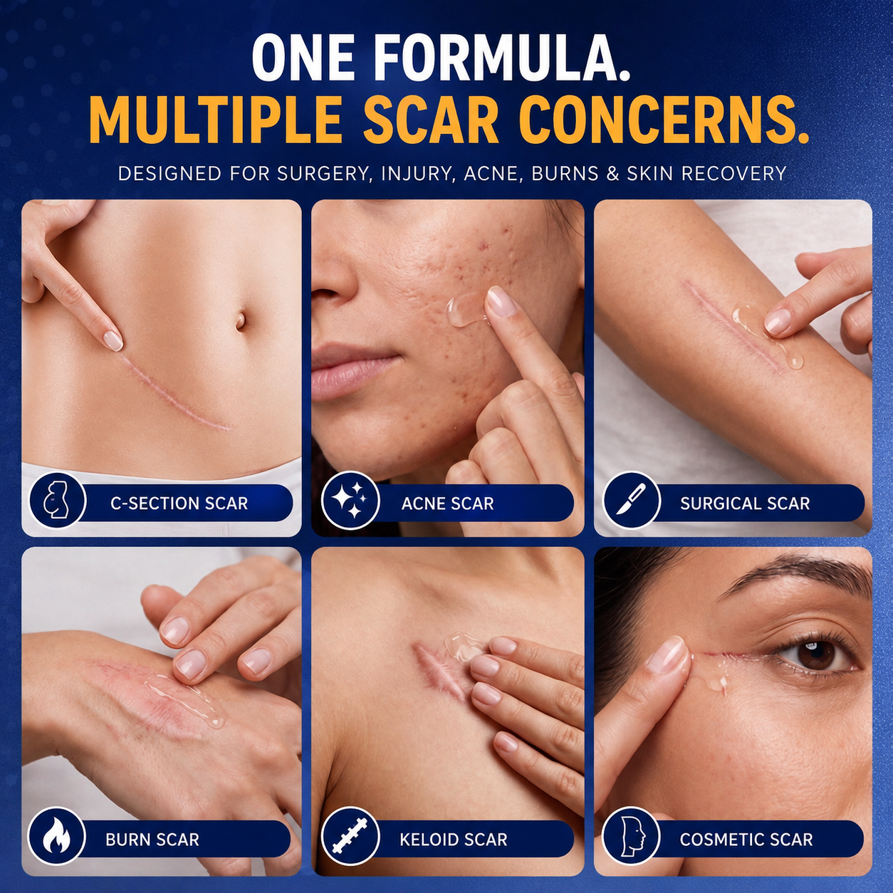 Joyivora Advanced Silicone Scar Smoothing Gel
