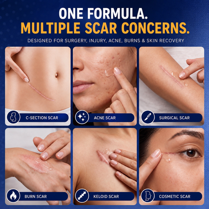 Joyivora Advanced Silicone Scar Smoothing Gel