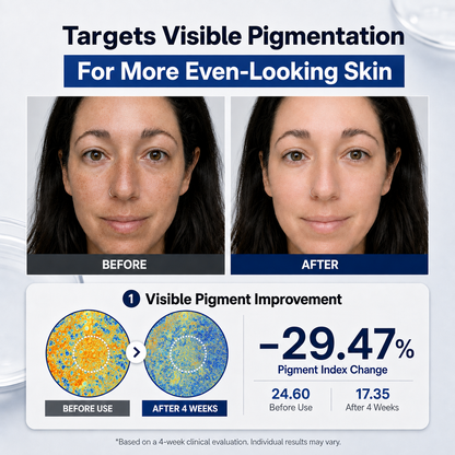 AURAWHISPERS Dark Spot Correcting Serum